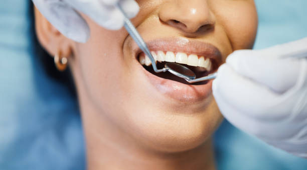 Best Emergency Dentist for Knocked-Out Tooth in Pistakee Highlands, IL