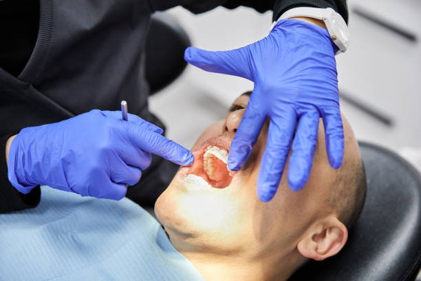 Best Broken or Cracked Tooth Emergency Dentist in Pistakee Highlands, IL